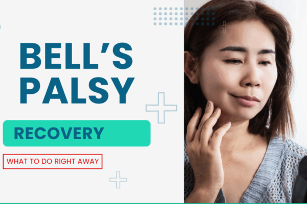 Bells-Palsy-1024x576